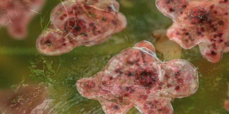 brain eating amoeba