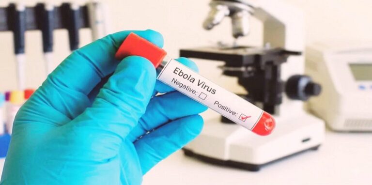 ebola virus